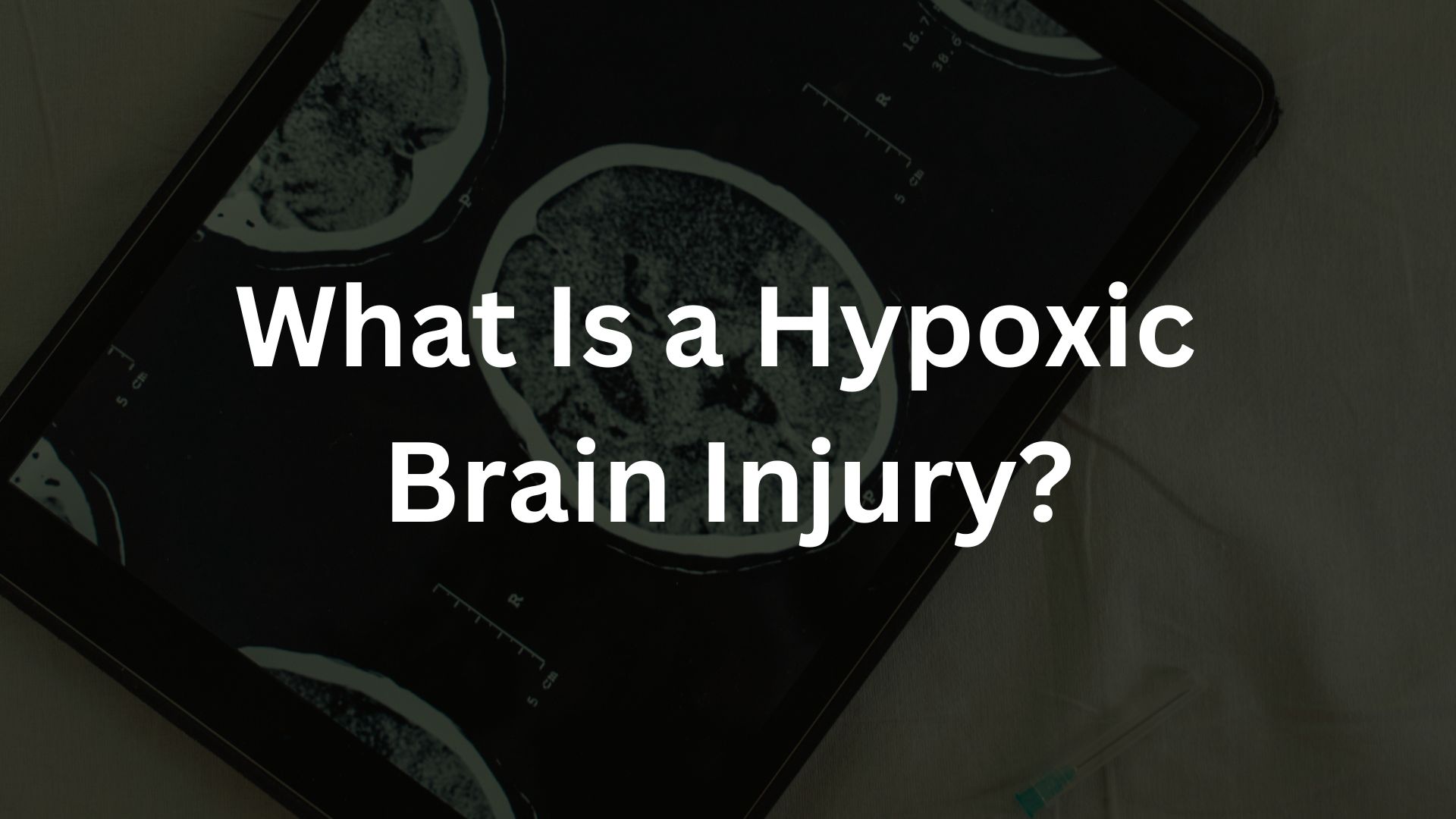 What Is a Hypoxic Brain Injury? - Front Range Injury Attorneys – Denver ...